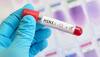 Swine flu symptoms