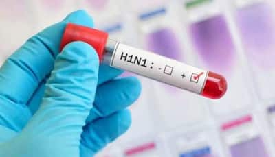 Is Swine Flu season beginning? Who is at risk for infection? All you need to know