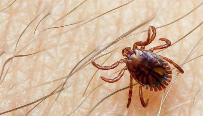 Crimean-Congo Haemorrhagic Fever case reported in Spain - Know all about tick-borne viral disease here