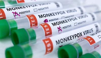 Monkeypox horror! THIS country reports 2 deaths in 2 days from virus