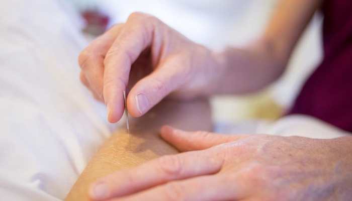 Diabetes management: Can acupuncture ward off blood sugar problems? Study finds THIS