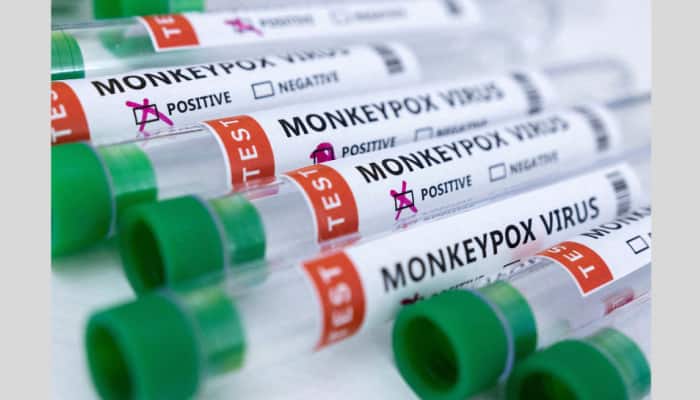 Monkeypox in India: All you need to know about NEW government guidelines