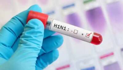 Swine Flu THREAT in Delhi? Experts warn about spike - Know symptoms, causes