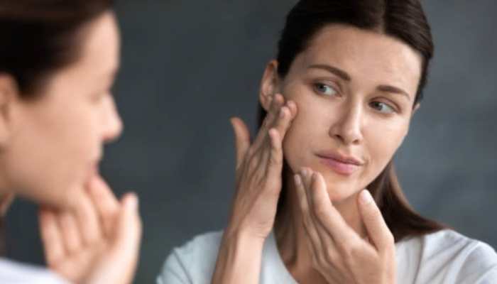 Don&#039;t pop that zit: 10 effective home remedies for acne