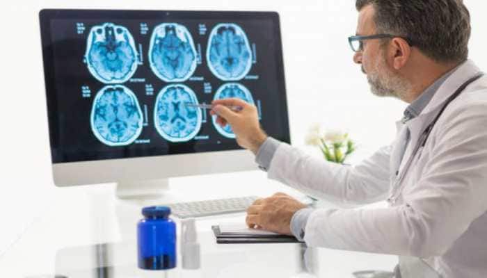 Clues revealed on what makes human brain different from other mammals: Study
