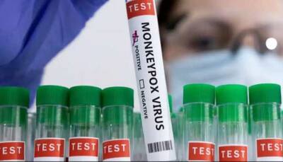 Monkeypox treatment: Antiviral tecovirimat found safe and effective, says study