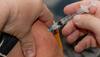 EXCLUSIVE: India's first cervical cancer vaccine - What causes cervical cancer, who can take vaccine & when
