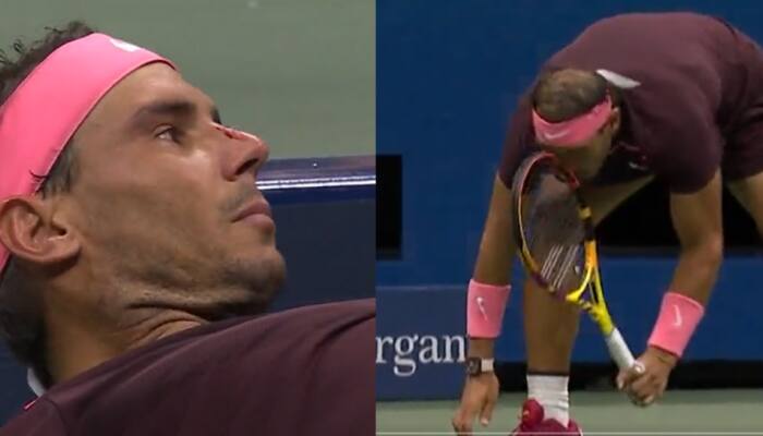 Rafael Nadal hits nose by own racket, blood pours out; beats Fabio Fognini in 2nd round of US Open - WATCH