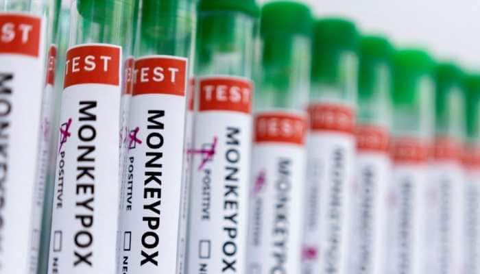 Can monkeypox lead to heart problems? New study REVEALS THIS