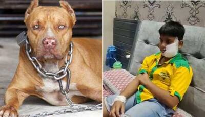 Ghaziabad: Pitbull dog bites 10-year-old boy's face and ears; victim gets 150 stitches - Watch