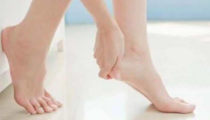 How To Cure Cracked Heels From the Inside Out - Domestic Geek Girl