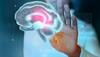 This is what happens in BRAIN when it becomes too hot