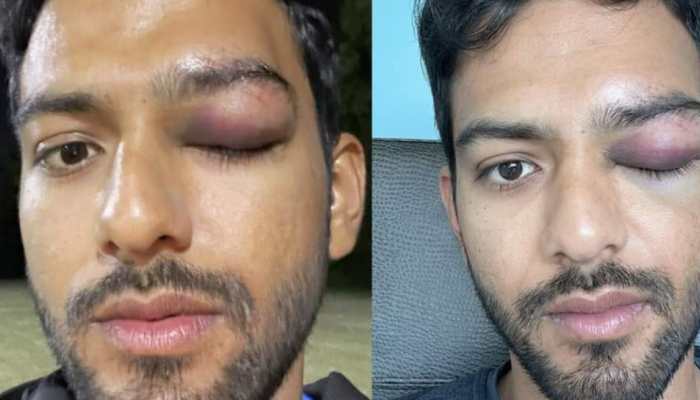 India's U-19 World Cup-winning captain suffers life-threatening injury