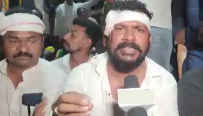 Congress MLA attacked by unidentified people in Gujarat, says &#039;Anyone who speaks up under BJP govt gets beaten’
