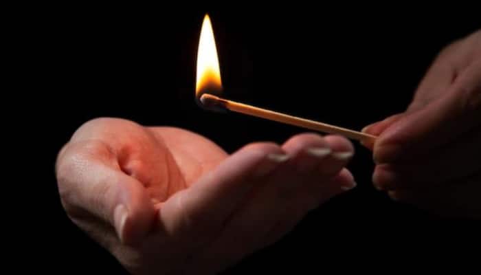 Diwali care 2022 : HERE are the do's &amp; don'ts for burn injuries