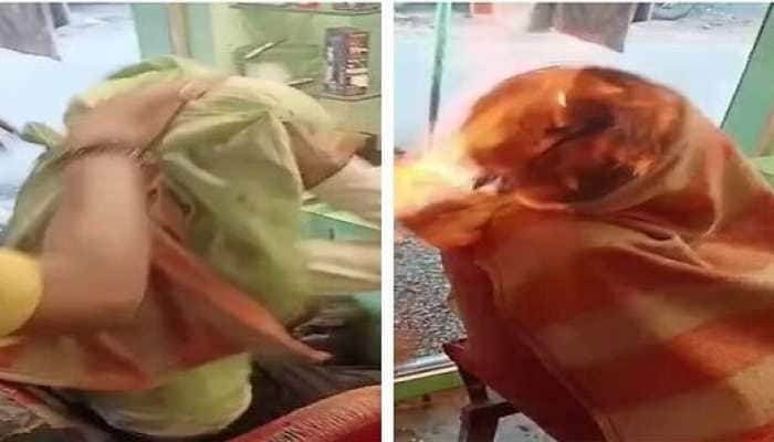 SHOCKING! Gujarat man suffers severe burns after &#039;FIRE HAIRCUT&#039; goes extremely wrong