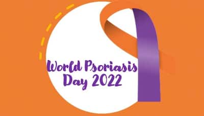 World Psoriasis Day 2022: Day, History, Significance, Theme and Symptoms