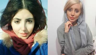  Remember 'Zombie Angelina Jolie' from Iran? Her REAL FACE revealed after coming out of prison 