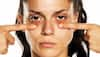 Skincare 101: 5 Home remedies to remove dark circles naturally