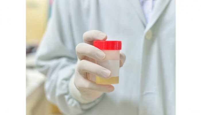 Fake Pee For Drug Test Review Of The