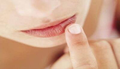 5 Most effective tips to keep your lips moist and crack-free this winter