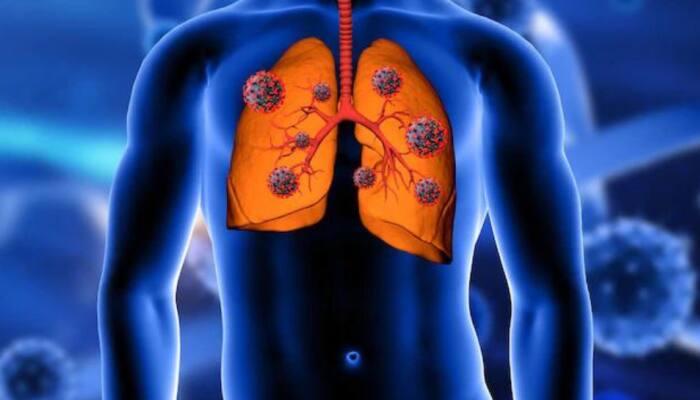 World Pneumonia Day: Maintain your respiratory health this winter with these tips