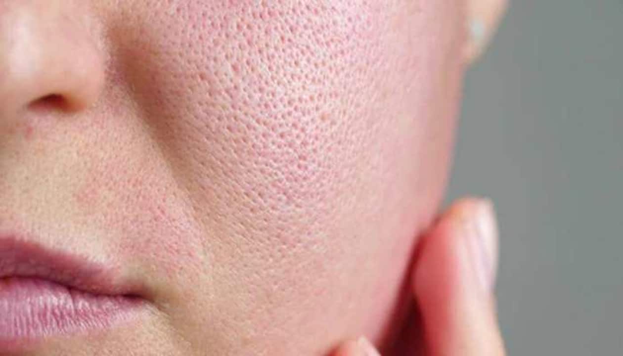 Skincare 101: 6 Best homemade face packs for open pores | Beauty/Fashion  News | Zee News