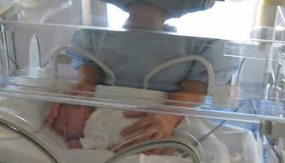 Exclusive: World Prematurity Day - How to take care of premature babies; complications, steps to follow