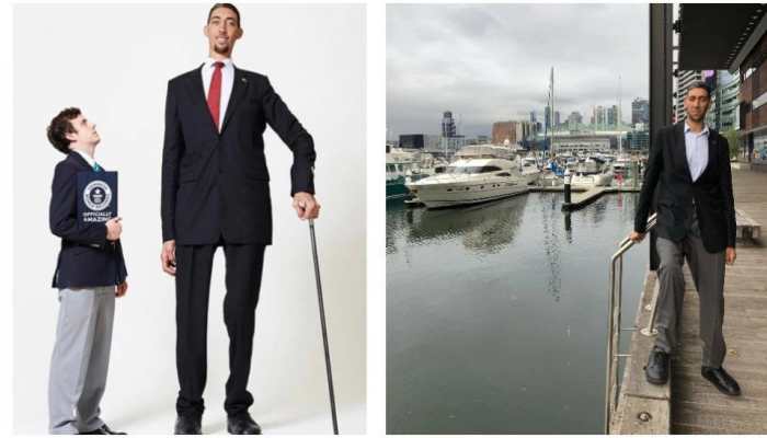 Unbelievable! A 68-year man becomes 3 inches taller in 3 months by spending Rs 1.2 crore; Here&#039;s everything you want to know