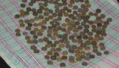 SHOCKING! 187 coins found in man’s stomach in Karnataka, removed after endoscopy