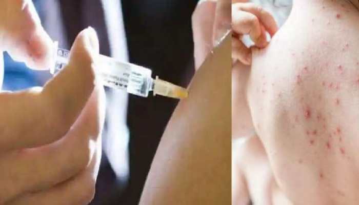 Measles OUTBREAK: Mumbai reports 23 new cases, starts vaccination drive