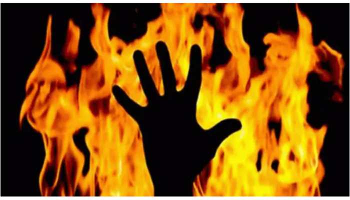 Karnataka SHOCKER! Woman SET ABLAZE her daughters due to family dispute, one dies