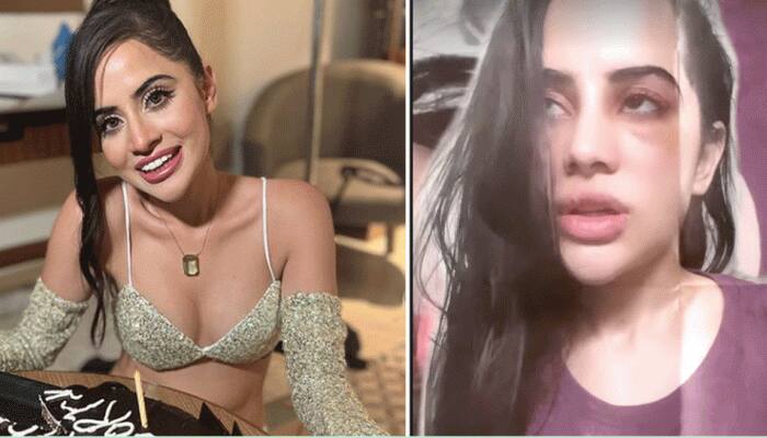 Urfi Javed&#039;s under-eye filler goes shockingly wrong, leaves her with swollen face, bruise, See Pics