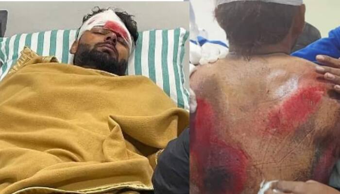 'Rishabh Pant can get INFECTED if...': DDCA official not HAPPY with so many VIP visitors in hospital, Read Here
