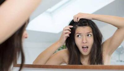 Get rid of dandruff with these 5 DIY home remedies for some haircare in winter