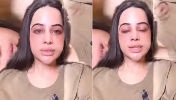 Urfi Javed REVEALS why she doesn’t wear clothes, says, ‘I have this serious condition’ 