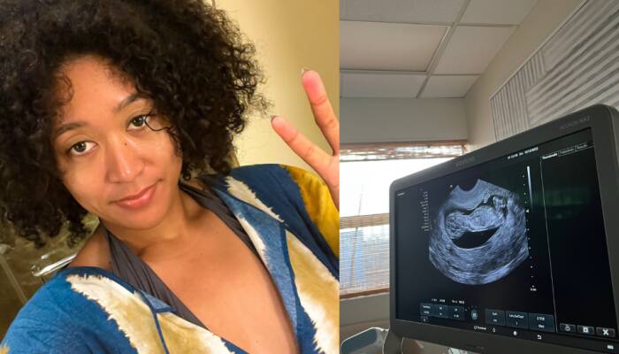 Naomi Osaka is PREGNANT, mother-to-be to miss entire 2023 season, read her note here