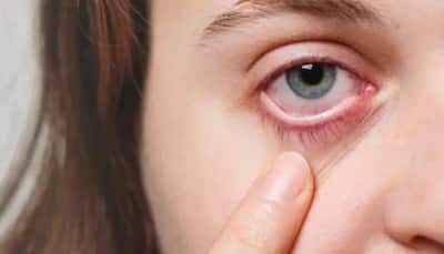 Childhood Glaucoma: Causes, Symptoms, Risk Factors, Prevention and Treatment