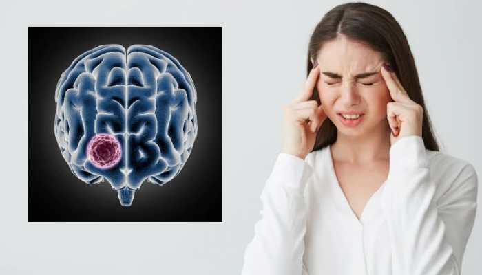 Head Injuries May Lead To Risk Of Brain Cancer: Study