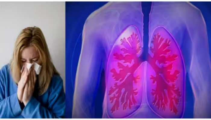 Influenza A Virus Subtype H3N2 Cases Rising, Patients Taking 'Longer Time' To Recover, Warn Experts