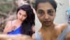 Malayalam Actress Anicka Vikhraman Shares Horrifying Pics of Bruise Marks, Accuses Ex-BF Of Assault