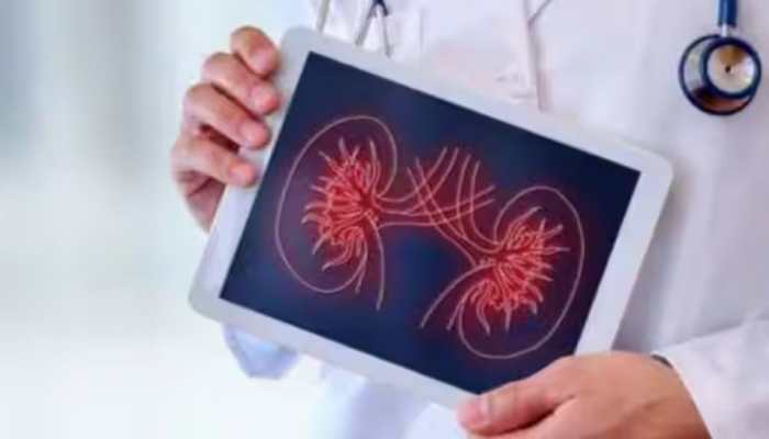 5 Diet Myths For Kidney Diseases BUSTED: What To Eat, What To Avoid - Check Expert&#039;s Suggestions 