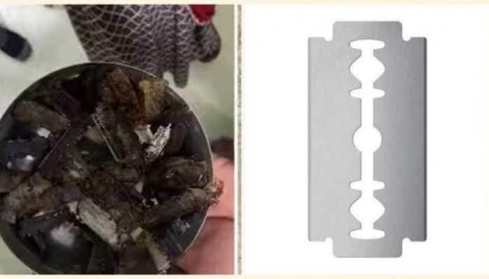 Rajasthan Shocker: Doctors Remove 56 Razor Blades From Man's Stomach