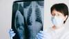 World Tuberculosis Day 2023: 10 Myths About TB BUSTED - Check How It Spreads