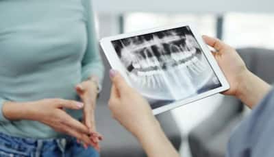 Dental Check-up: Why Should You Get A Dental X-ray Done? Experts Shares The Significance Of Regular Dentist Visits