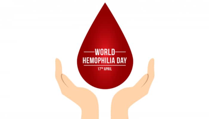 World Hemophilia Day 2023: Symptoms, Causes, Diagnosis And Treatment Of This Rare Blood Disorder