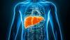 World Liver Day 2023: The Impact Of Alcohol, Junk Food, And Sugar On Liver