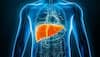 Liver Diseases