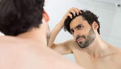 Treating Oily Scalp: 5 Tips For Men To Follow
