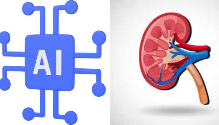 AI Can Predict Diabetic Kidney Disease Early Via Simple Blood Sample